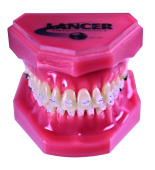 Керамические брекеты LANCER INTRIGUE SILK WHISPER