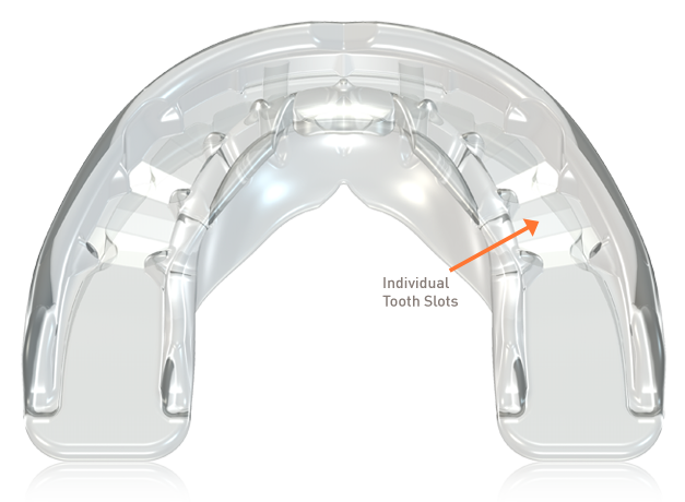 Аппарат MYOBRACE T1 Medium, для подростков 10-15 лет, голубой, MRC