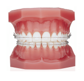 Сапфировые брекеты ORMCO INSPIRE ICE .018 ROTH