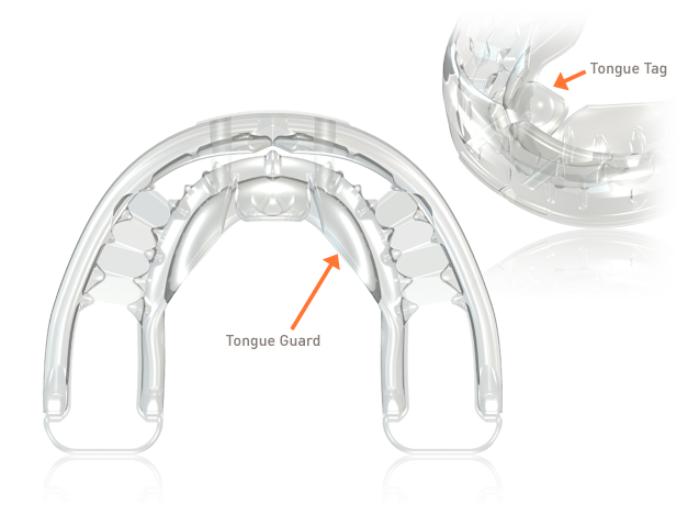 Аппарат MYOBRACE T1 Medium, для подростков 10-15 лет, голубой, MRC