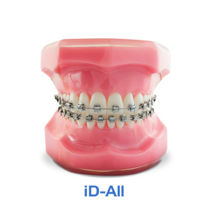 НАБОР брекетов ID-ALL .022 CAPELOZZA II С КР. на 3. 4. 5, 20 шт