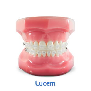Типодонт LUCEM: керамические лигатурные
