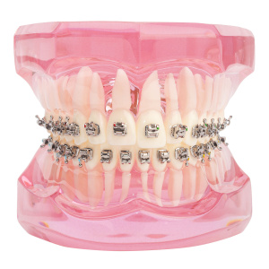 Типодонт металлические самолигирующие SELF-LIGATING SERIES .022 ROTH