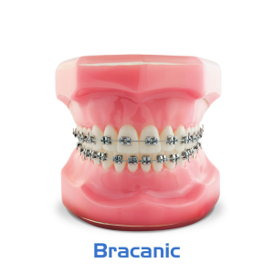 Типодонт BRACANIC STANDART: металлические лигатурные