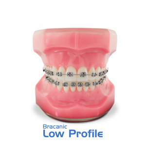Типодонт BRACANIC LOW PROFILE: металлические лигатурные низкопрофильные