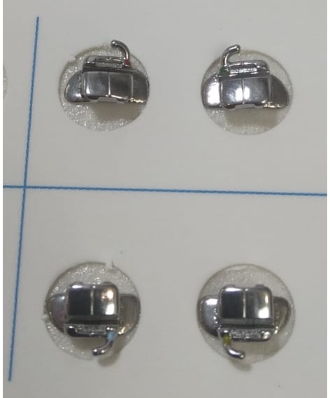 Замок самолигирующий с крючком ROTH .022 DIAMOND ULTRA, НЧ/прав., на 46 зуб