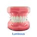 Брекет LUMINOUS .022 ROTH 2-й премоляр С КРЮЧКАМИ НЧ/лев, на 35 зуб