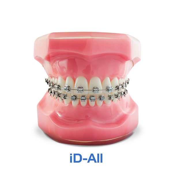 Брекет ID-ALL .022 CAPELOZZA III клык С КРЮЧКОМ НЧ/прав, на 43 зуб