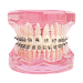 Брекет SELF-LIGATING SERIES .022 MBT 2-й премоляр с кр. НЧ/лев, на 35 зуб