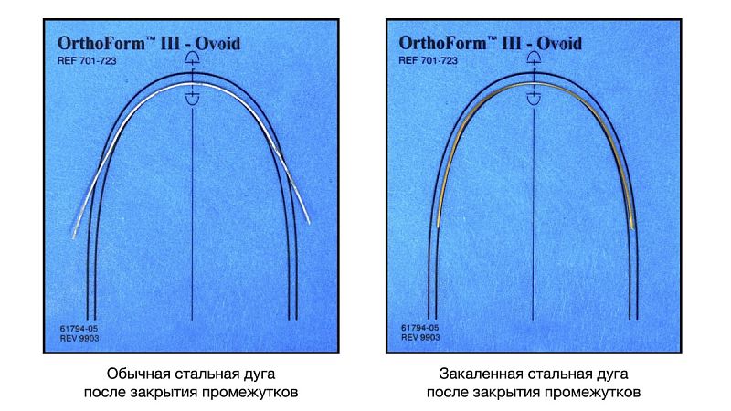 Аппарат Powerarch для закаливания стальных дуг, РФ