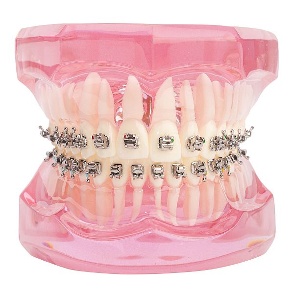 Типодонт металлические самолигирующие SELF-LIGATING SERIES .022 ROTH